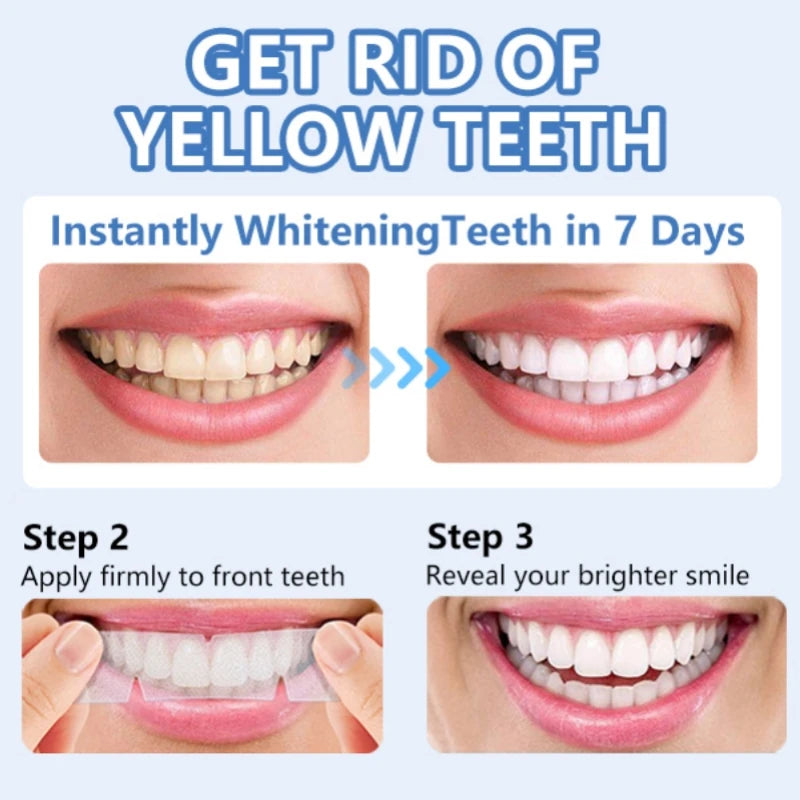 Teeth Whitening Strips (28pairs)
