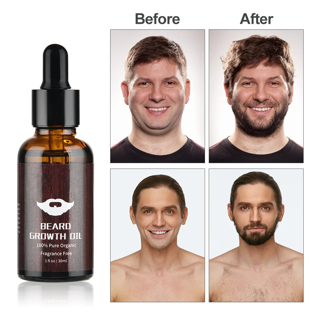 Essential Oil Moisturising beard growth